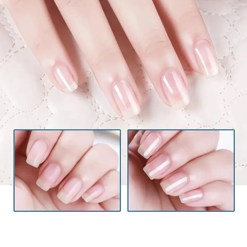 🔥Last Day 49% OFF💖💕Nail Care Formula